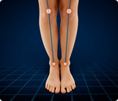 leg axis
