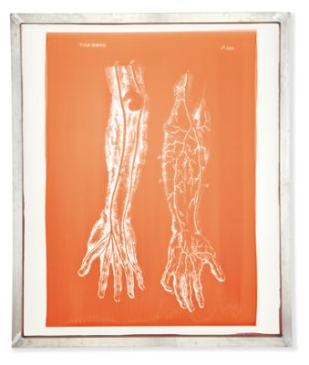 Framed Screen Art, Arm