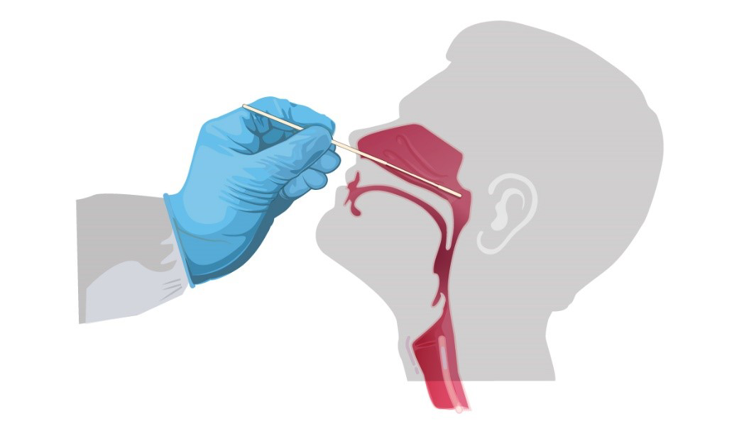 COVID19 Nasopharyngeal Swabs Packaged in DuPont™ Tyvek® Highlight