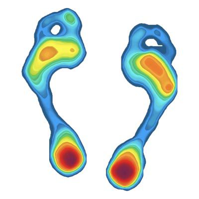 Bottom of a foot shape with concentric colors indicating more or less pressure on parts of the foot; there is less pressure toward the outside of the foot, moderate pressure on the ball, and greatest pressure in the heel.